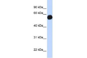 AKAP1 antibody used at 1 ug/ml to detect target protein. (AKAP1 antibody)