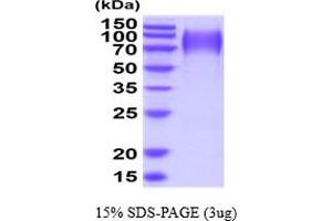 SDS-PAGE (SDS) image for Podocalyxin-Like (PODXL) (AA 22-404) protein (His tag) (ABIN5854527) (PODXL Protein (AA 22-404) (His tag))