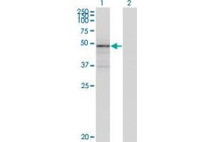 Western Blot analysis of TNXB expression in transfected 293T cell line by TNXB monoclonal antibody (M01), clone 2D3-1B10. (TNXB antibody  (AA 1-673))
