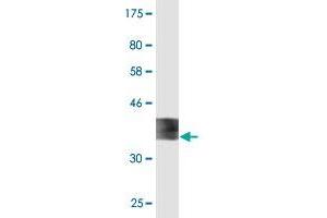 Western Blot detection against Immunogen (36. (Ferredoxin1 (FDX1) (AA 85-183) antibody)