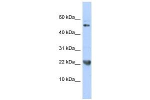 TNFSF12 antibody used at 1 ug/ml to detect target protein. (TWEAK antibody)