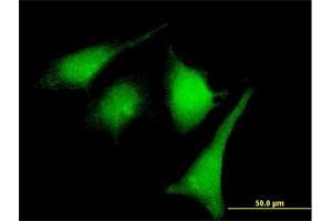 Immunofluorescence of purified MaxPab rabbit antibody to MAP2K2 on HeLa cell. (MEK2 antibody  (AA 1-400))