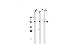 All lanes : Anti-AIRE Antibody (Center) at 1:2000 dilution Lane 1: Hela whole cell lysate Lane 2: U-20S whole cell lysate Lane 3: K562 whole cell lysate Lysates/proteins at 20 μg per lane. (AIRE antibody  (AA 64-92))