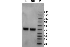Human Fc gamma RIIa / CD32a (167R) protein on Coomassie Blue stained SDS-PAGE under non-reducing (NR) and reducing (R) conditions. (FCGR2A Protein (AA 36-218) (His-Avi Tag,Biotin))