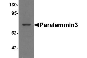 Western blot analysis of Paralemmin3 in MCF7 cell lysate with Paralemmin3 antibody at 1 µg/mL. (PALM3 antibody  (N-Term))