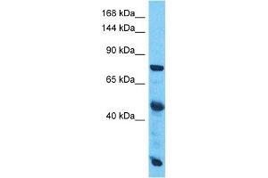 Host:  Rabbit  Target Name:  SLC38A10  Sample Type:  Esophagus Tumor lysates  Antibody Dilution:  1. (SLC38A10 antibody  (C-Term))