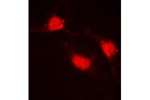 Immunofluorescent analysis of Beta-catenin staining in HeLa cells. (beta Catenin antibody  (C-Term))