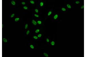 Immunofluorescence (IF) image for anti-Splicing Factor 3b, Subunit 1, 155kDa (SF3B1) antibody (ABIN7127805)