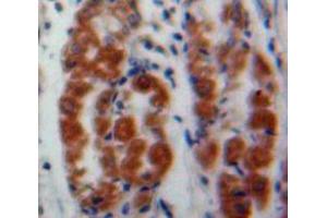 IHC-P analysis of Stomach tissue, with DAB staining. (MAEA antibody  (AA 136-379))