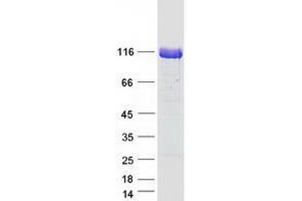 Unc5c Protein (Myc-DYKDDDDK Tag)