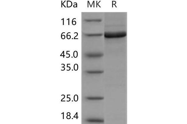 PTK6 Protein (GST tag,His tag)
