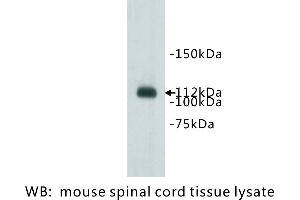 Image no. 1 for anti-Transmembrane Protein 67 (TMEM67) antibody (ABIN1112910) (TMEM67 antibody)