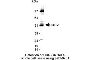 Image no. 2 for anti-Cerebellar Degeneration-Related Protein 2, 62kDa (CDR2) (C-Term) antibody (ABIN363590) (CDR2 antibody  (C-Term))