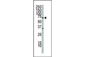 Western blot analysis of anti-PI3KR2 Pab 8024b in A549 cell lysate. (PIK3R2 antibody  (C-Term))