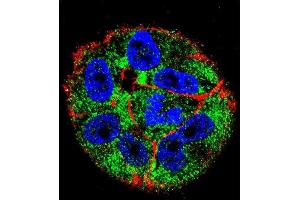 Confocal immunofluorescent analysis of p53 Antibody (S15) (ABIN390201 and ABIN2840688) with  cell followed by Alexa Fluor 488-conjugated goat anti-rabbit lgG (green). (p53 antibody  (AA 1-30))