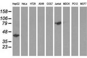 Western blot analysis of extracts (35 µg) from 9 different cell lines by using anti-HP monoclonal antibody. (Haptoglobin antibody)