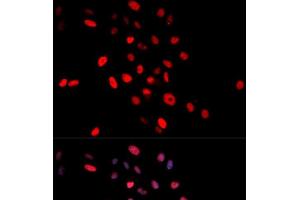 Immunofluorescence analysis of MCF-7 cells using Phospho-c-Jun(S63) Polyclonal Antibody (C-JUN antibody  (pSer63))