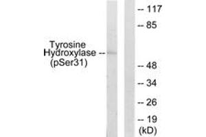 Western blot analysis of extracts from 293 cells treated with UV 15', using Tyrosine Hydroxylase (Phospho-Ser31) Antibody. (Tyrosine Hydroxylase antibody  (pSer62))