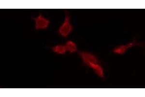 ABIN6275659 staining HepG2 by IF/ICC. (USP45 antibody  (Internal Region))
