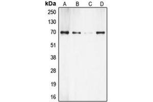 Western blot analysis of S6K1 expression in HeLa (A), HEK293 (B), MDCK (C), mouse brain (D) whole cell lysates. (RPS6KB1 antibody  (C-Term))