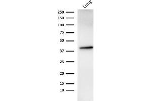 Western Blotting (WB) image for anti-Epithelial Cell Adhesion Molecule (EPCAM) antibody (ABIN6939981)