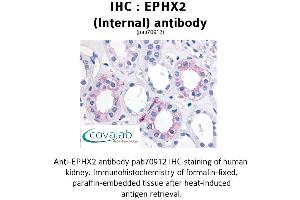 Image no. 1 for anti-Epoxide Hydrolase 2, Cytoplasmic (EPHX2) (Internal Region) antibody (ABIN1734089) (EPHX2 antibody  (Internal Region))