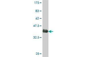 Western Blot detection against Immunogen (37. (MLKL antibody  (AA 371-471))