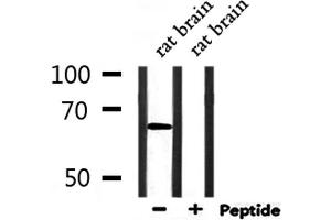 Western blot analysis of extracts from rat brain, using PINK1 Antibody. (PINK1 antibody)