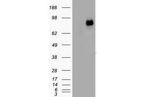 HEK293T cells were transfected with the pCMV6-ENTRY control (Left lane) or pCMV6-ENTRY CTNNB1 (Right lane) cDNA for 48 hrs and lysed. (CTNNB1 antibody  (AA 531-781))