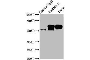 Western Blotting (WB) image for anti-Heterogeneous Nuclear Ribonucleoprotein K (HNRNPK) antibody (ABIN7127548)