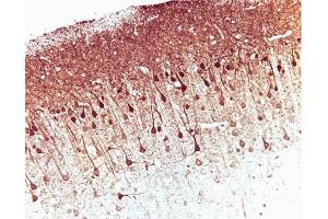 Immunohistochemical staining on a rat brain formalin-fixed paraffin-embedded section with citrate buffer pretreatment (20X magnification). (ERK (Pan) (AA 219-358) antibody)