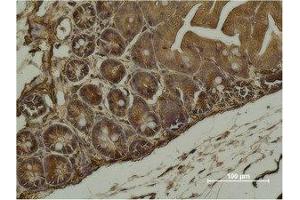 Immunohistochemical analysis of paraffin-embedded Mouse Cecal Tissue using α-SMA Monoclonal Antibody. (Smooth Muscle Actin antibody)