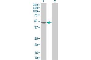 Western Blotting (WB) image for TNS1 293T Cell Transient Overexpression Lysate(Denatured) (ABIN1333762)