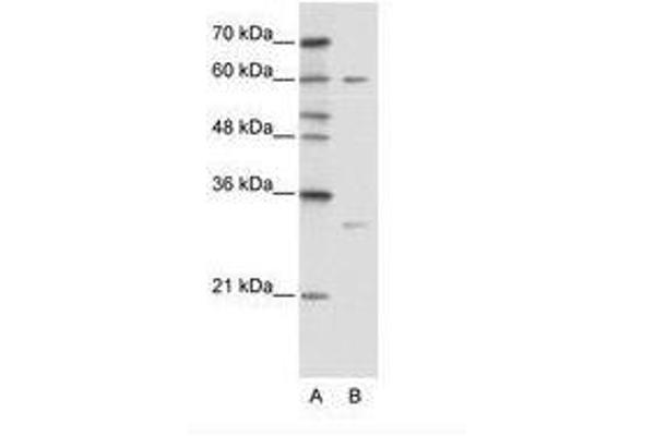 ZNF395 antibody  (AA 361-410)