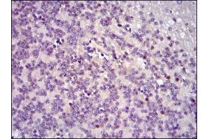 Immunohistochemistry (IHC) image for anti-c-Fos (c-Fos) antibody (ABIN969150)