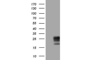 Western Blotting (WB) image for anti-Adiponectin (ADIPOQ) (AA 19-244) antibody (ABIN2715784) (ADIPOQ antibody  (AA 19-244))