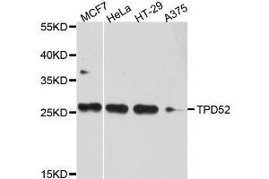 Western blot analysis of extracts of various cell lines, using TPD52 antibody. (TPD52 antibody  (AA 1-184))