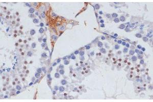 Immunohistochemistry of paraffin-embedded Mouse testis using SKIV2L2 Polyclonal Antibody at dilution of 1:100 (40x lens). (MTR4 antibody)