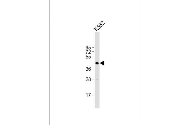 SIRT6 antibody  (C-Term)