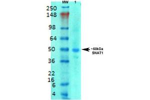Western Blot analysis of Rat brain membrane lysate showing detection of SLC38A1 protein using Mouse Anti-SLC38A1 Monoclonal Antibody, Clone S104-32 . (SLC38A1 antibody  (AA 1-63) (Atto 594))