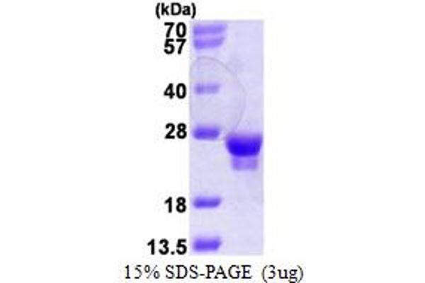 RAB18 Protein (AA 1-206) (His tag)