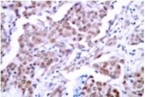 Image no. 2 for anti-Tumor Protein P53 (TP53) (pSer15) antibody (ABIN318091) (p53 antibody  (pSer15))