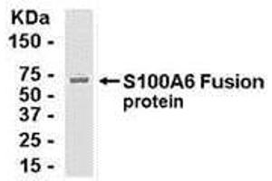 Western Blotting (WB) image for anti-S100 Calcium Binding Protein A6 (S100A6) (AA 1-90) antibody (ABIN2468141) (S100A6 antibody  (AA 1-90))