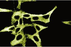 Immunofluorescence staining of HeLa cells. (PKA RIIalpha (AA 1-404) antibody)