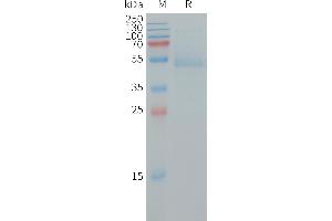 Human RHOB Protein, hFc Tag on SDS-PAGE under reducing condition. (RHOB Protein (AA 1-188) (Fc Tag))