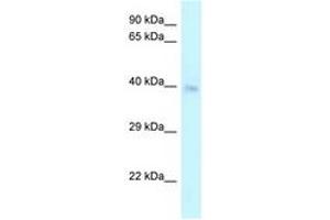 Image no. 1 for anti-Cysteine-Rich with EGF-Like Domains 2 (CRELD2) (C-Term) antibody (ABIN6747709) (CRELD2 antibody  (C-Term))