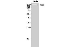 Western Blotting (WB) image for anti-Angiotensin I Converting Enzyme (Peptidyl-Dipeptidase A) 1 (ACE) (Internal Region) antibody (ABIN3183143) (Angiotensin I Converting Enzyme 1 antibody  (Internal Region))