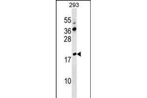 溶菌酶样4抗体（AA 37-63）