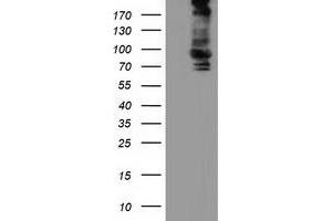 HEK293T cells were transfected with the pCMV6-ENTRY control (Left lane) or pCMV6-ENTRY ALDH1L1 (Right lane) cDNA for 48 hrs and lysed. (ALDH1L1 antibody)