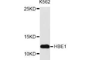 Western blot analysis of extracts of K-562 cells, using HBE1 antibody (ABIN5972085) at 1/1000 dilution. (Hemoglobin, epsilon 1 (HBe1) antibody)